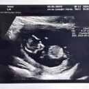 지엠산부인과의원 이미지