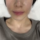 디어봄브뷰티 | 광안리 입술문신 , 부산 남천동 입술문신 잘하는 곳 , 베어진 입술문신 모델 후기