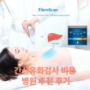 감창우내과의원 | 간섬유화검사 비용과 병원 추천 후기