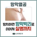 망막열공 방치하면 망막박리로 이어져 실명까지 초래해요! 이미지