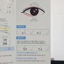 수원퍼스트안과의원 | 수원 퍼스트안과 스마일라식 하러 갔다가 라섹 권유받음 > 원추각막 의심 판정