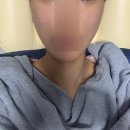 차이성형외과 | 마이라인성형외과 피팅리프팅 솔직후기, 이중턱 리프팅 변화