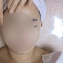 수원시 팔달구 향교로 93 | 수원역피부관리 &#39;에스테라피 스킨케어&#39;에서 밀리옴테라피 받고 광명 찾았어요