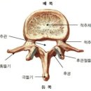 요추 횡돌기 골절[Fracture of Transverse process] 이미지