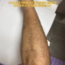 샵고릴라 | 다리털 많은 남자가 써본 고릴라왁싱 후기! 모근제거기 추천 받을 만할까?