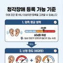 종로-연건-종로-연-247 | 보청기지원금, 나도 받을 수 있을까? 지원조건·금액·절차 한 번에 정리!