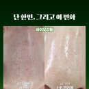 바이오에스테 이미지