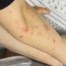 탈스테이 이미지