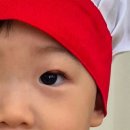 샤일리안과의원 | 수원 아기 다래끼 병원 찾기 22개월 다래끼치료 과정 기록 1탄