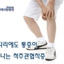 척추관협착증, 병원 빨리 찾으면 치료가 쉽다 이미지