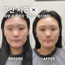부산 서면 피부·윤곽관리 달리아 에스테틱, 약손명가 노하우 그대로!