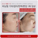 에스테틱새로움