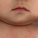 닥터더마퍼트 카밍워터 후기｜침독부터 기저귀 자극까지 피부진정 케어
