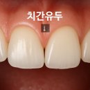 세모치과의원 네이버블로그