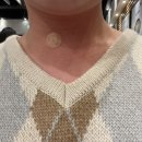 송 외과 | [갑상선암 투병일기 1] 송도유외과 세침검사 후기 및 베데스다 5단계 진단