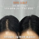 돕스칼프