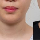 뷰리프성형외과의원 이미지