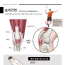 혁신원광한의원 네이버블로그