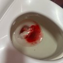 설보비 | [항문 수술의 모든것]항문농양수술,응꼬수술후기,지혈안됨,재수술,치루가능성, 봉합,좌욕, 변비, 출혈...