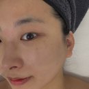 아쿠아플러스 남대구점 | 대구피부관리 라플러스에스떼 광채 피부 아쿠아필 후기