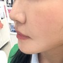 피부간지러움 심할 때 찾게 되는 피부장벽크림 추천속건조까지 편안했던 아토스토리 아토엠크림 후기