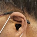 포낙보청기 이미지