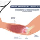 뉴로하이짐 이미지