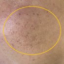 네이처한의원 | 부천여드름흉터, 꼼꼼한 여의사가 치료하는 미앤네이처한의원