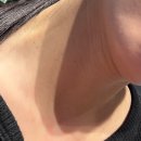 다인한의원 | [내돈내산] 더힘찬한의원 해운대점에서 10만원대 사마귀 뺀 후기 푼다…as가 된다니…혐오 주의(사마귀...