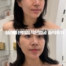 센텀 | 재방문 해운대 에스테틱 작은얼굴 끌리메 센텀점 솔직후기