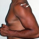 컨스타골프 | 상완골전방활주증후군과 전방활주가 심해질 경우-로즈필라테스