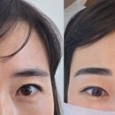 까진눈썹