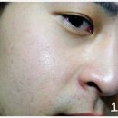 헤어시에프(CF)