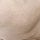 전북혁신도시 힐링콘서트 1차 | [전주혁신도시피부샵] 전주 리프팅관리 강력추천, "사계절피부공간"