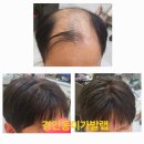 씨유 광주경안중앙점 | 경기 광주 남자가발 잘하는 경안동미가발~두번째맞춤가발후기