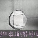 오빠가 간다 | 오빠 따라 동탄간다! 명품 중성화 수술위해 찾아온 코코의 이야기