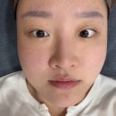 벨로체 | 을지로피부과 잡티제거 벨로체 추천 내돈내산 후기