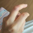 화이자 백신후기 1일차, 화이자 잔여백신, 양천구 신월동 문형한내과의원 백신접종 완료