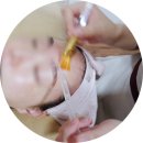 서윤피부맑음 수내점 | 분당 피부관리 서윤피부맑음 수내점에서 각질 모공 관리 후기