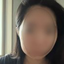 효치과의원 | 완전 매복 사랑니 발치 후기_강남 레옹 치과
