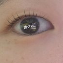 청광수퍼 | 스마일프로라식_1년6개월 후기_내돈내산