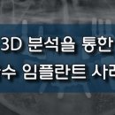 진플란트치과의원 이미지