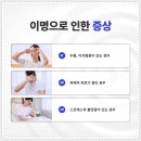 안암한의원 네이버블로그