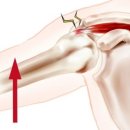 백석정형외과의원 이미지