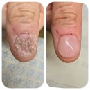 동해 바이오환경 | 강릉 동해 문제성손톱 관리, 손상된 손톱 회복, 손톱연장 전문네일샵 강릉리본네일