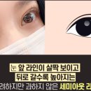 팝성형외과의원 이미지