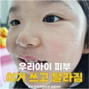 주식회사 씨엔케이월드와이드 | 초등학생 로션 추천, 피부건조 해결! 코덱시알 익스트림 아기보습크림 후기