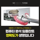 보정치과기공소 | 부산네비게이션임플란트? 수술 정확도 높이는 이유