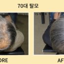 동명헤어라인