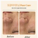 힐에스테틱 네이버블로그